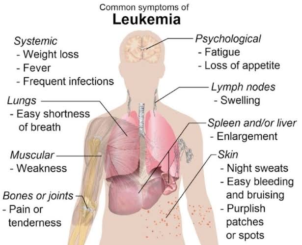 llekomiss does not work